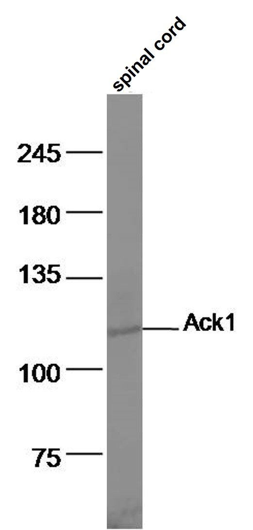 Mouse spinal cord lysates probed with Ack1 Polyclonal Antibody, Unconjugated (bs-1227R) at 1:500 dilution and 4˚C overnight incubation. Followed by conjugated secondary antibody incubation at 1:10000 for 60 min at 37˚C.