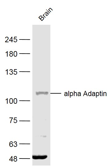 Mouse brain lysates probed with alpha Adaptin Polyclonal Antibody, Unconjugated (bs-1228R) at 1:500 dilution and 4˚C overnight incubation. Followed by conjugated secondary antibody incubation at 1:10000 for 60 min at 37˚C.