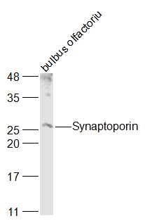 Rat bulbus olfactorius lysates probed with Synaptoporin Polyclonal Antibody, Unconjugated (bs-11367R) at 1:1000 dilution and 4˚C overnight incubation. Followed by conjugated secondary antibody incubation at 1:10000 for 60 min at 37˚C. Rat bulbus olfactorius lysates probed with Synaptoporin Polyclonal Antibody, Unconjugated (bs-11367R) at 1:1000 dilution and 4˚C overnight incubation. Followed by conjugated secondary antibody incubation at 1:10000 for 60 min at 37˚C.