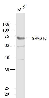 Rat testis lysates probed with SPAG16 Polyclonal Antibody, Unconjugated (bs-11485R) at 1:1000 dilution and 4˚C overnight incubation. Followed by conjugated secondary antibody incubation at 1:10000 for 60 min at 37˚C.