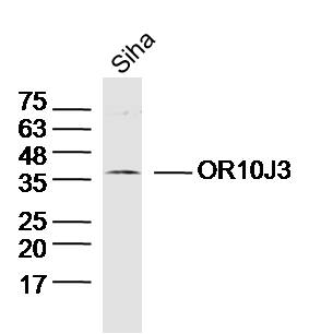 Siha cell lysates probed with OR10J3 Polyclonal Antibody, Unconjugated (bs-11629R) at 1:300 dilution and 4˚C overnight incubation. Followed by conjugated secondary antibody incubation at 1:10000 for 60 min at 37˚C.