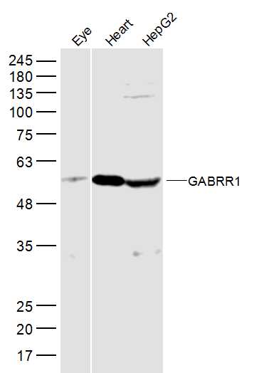 Lane 1: Mouse eye lysates;Lane 2: Mouse heart lysates; Lane 3: HepG2 cell lysates probed with GABRR1 Polyclonal Antibody, Unconjugated (bs-12084R) at 1:300 dilution and 4˚C overnight incubation. Followed by conjugated secondary antibody incubation at 1:10000 for 60 min at 37˚C.