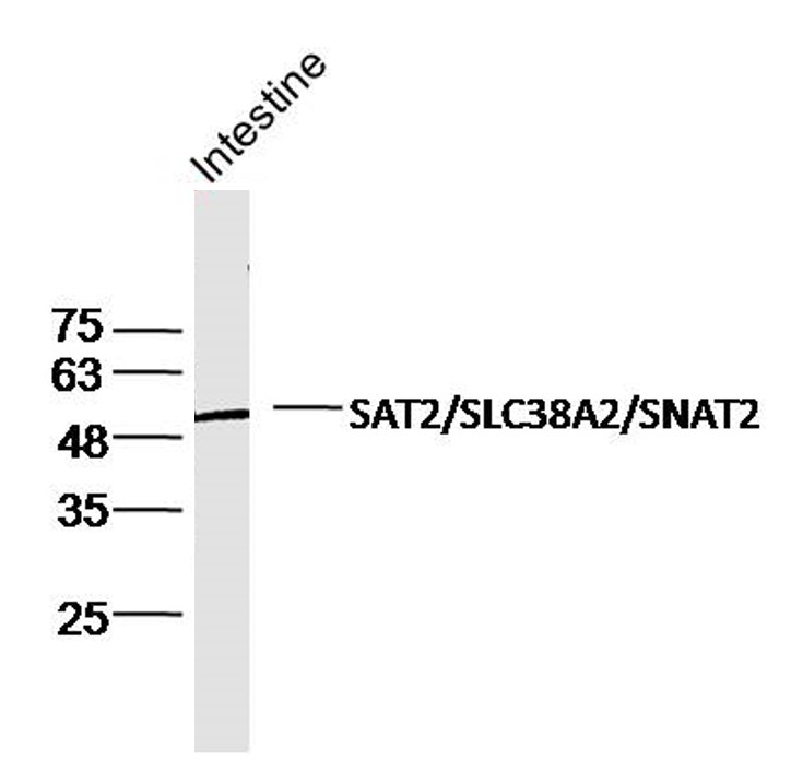 Mouse intestine lysates probed with SLC38A2 Polyclonal Antibody, Unconjugated (bs-12125R) at 1:300 dilution and 4˚C overnight incubation. Followed by conjugated secondary antibody incubation at 1:10000 for 60 min at 37˚C.