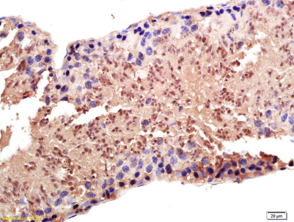 Formalin-fixed and paraffin embedded rat testis labeled with Anti-PAPOG Polyclonal Antibody, Unconjugated (bs-4968R) at 1:200 followed by conjugation to the secondary antibody and DAB staining.
