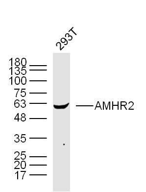 293T cell lysates probed with AMHR2 Polyclonal Antibody, Unconjugated (bs-12414R) at 1:300 dilution and 4˚C overnight incubation. Followed by conjugated secondary antibody incubation at 1:10000 for 60 min at 37˚C.