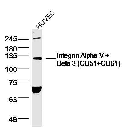 HUVEC cell lysates probed with Integrin Alpha V + Beta 3 (CD51+CD61) Polyclonal Antibody, Unconjugated (bs-1310R) at 1:300 dilution and 4˚C overnight incubation. Followed by conjugated secondary antibody incubation at 1:10000 for 60 min at 37˚C.