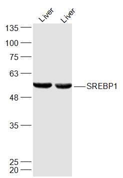 Lane 1: Mouse liver lysates; Lane 2:Rat Liver lysates probed with SREBP1 Polyclonal Antibody, Unconjugated (bs-1402R) at 1:300 dilution and 4˚C overnight incubation. Followed by conjugated secondary antibody incubation at 1:10000 for 60 min at 37˚C.