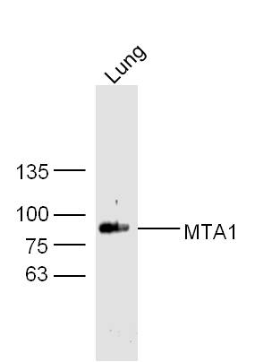 Mouse lung lysates probed with MTA1 Polyclonal Antibody, Unconjugated (bs-1412R) at 1:300 dilution and 4˚C overnight incubation. Followed by conjugated secondary antibody incubation at 1:10000 for 60 min at 37˚C.