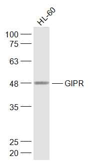 HL-60 cell lysates probed with GIPR Polyclonal Antibody, Unconjugated (bs-13292R) at 1:1000 dilution and 4˚C overnight incubation. Followed by conjugated secondary antibody incubation at 1:10000 for 60 min at 37˚C.