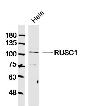 Hela cell lysates probed with RUSC1 Polyclonal Antibody, Unconjugated (bs-13677R) at 1:300 dilution and 4˚C overnight incubation. Followed by conjugated secondary antibody incubation at 1:10000 for 60 min at 37˚C. Hela cell lysates probed with RUSC1 Polyclonal Antibody, Unconjugated (bs-13677R) at 1:300 dilution and 4˚C overnight incubation. Followed by conjugated secondary antibody incubation at 1:10000 for 60 min at 37˚C.