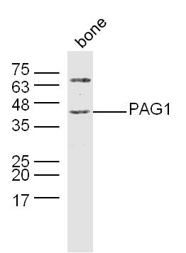 Mouse bone lysates probed with PAG1 Polyclonal Antibody, Unconjugated (bs-13695R) at 1:300 dilution and 4˚C overnight incubation. Followed by conjugated secondary antibody incubation at 1:10000 for 60 min at 37˚C.