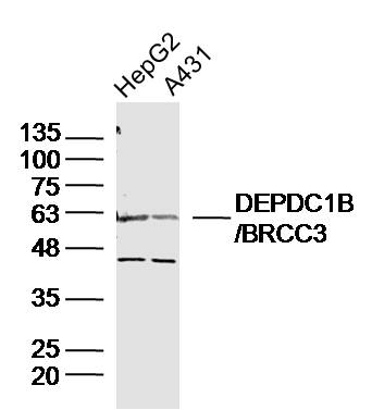 Lane 1: HepG2 cell lysates; Lane 2: A549 cell lysates probed with DEPDC1B/BRCC3 Polyclonal Antibody, Unconjugated (bs-14278R) at 1:300 dilution and 4˚C overnight incubation. Followed by conjugated secondary antibody incubation at 1:10000 for 60 min at 37˚C.