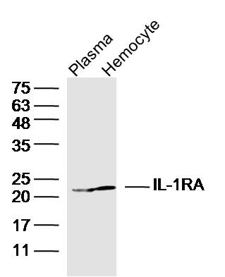 Lane 1: Mouse plasma lysates; Lane 2: Mouse hemocyte lysates probed with IL-1RA Polyclonal Antibody, Unconjugated (bs-2216R) at 1:300 dilution and 4˚C overnight incubation. Followed by conjugated secondary antibody incubation at 1:10000 for 60 min at 37˚C.