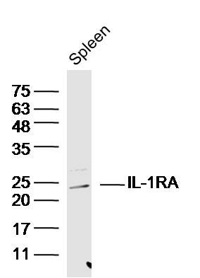 Mouse spleen lysates probed with IL-1RA Polyclonal Antibody, Unconjugated (bs-2216R) at 1:300 dilution and 4˚C overnight incubation. Followed by conjugated secondary antibody incubation at 1:10000 for 60 min at 37˚C.