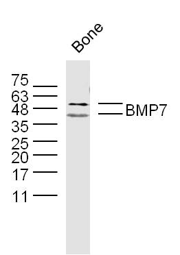 Mouse bone lysates probed with BMP7 Polyclonal Antibody, Unconjugated (bs-2242R) at 1:300 dilution and 4˚C overnight incubation. Followed by conjugated secondary antibody incubation at 1:10000 for 60 min at 37˚C.