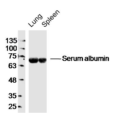 Lane 1: Mouse lung lysates; Lane 2: Mouse spleen lysates probed with Mouse serum albumin Polyclonal Antibody, Unconjugated (bs-2256R) at 1:300 dilution and 4˚C overnight incubation. Followed by conjugated secondary antibody incubation at 1:10000 for 60 min at 37˚C. Lane 1: Mouse lung lysates; Lane 2: Mouse spleen lysates probed with Mouse serum albumin Polyclonal Antibody, Unconjugated (bs-2256R) at 1:300 dilution and 4˚C overnight incubation. Followed by conjugated secondary antibody incubation at 1:10000 for 60 min at 37˚C.