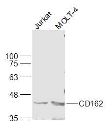 Lane 1: Jurkat cell lysates; Lane 2: MOLT-4 cell lysates probed with CD162 Polyclonal Antibody, Unconjugated (bs-2301R) at 1:500 dilution and 4˚C overnight incubation. Followed by conjugated secondary antibody incubation at 1:10000 for 60 min at 37˚C.