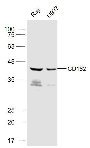 Lane 1: Raji cell lysates; Lane 2: U937 cell lysates probed with CD162 Polyclonal Antibody, Unconjugated (bs-2301R) at 1:500 dilution and 4˚C overnight incubation. Followed by conjugated secondary antibody incubation at 1:10000 for 60 min at 37˚C.