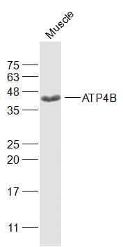 Mouse muscle lysates probed with ATP4B Polyclonal Antibody, Unconjugated (bs-2433R) at 1:1000 dilution and 4˚C overnight incubation. Followed by conjugated secondary antibody incubation at 1:10000 for 60 min at 37˚C.