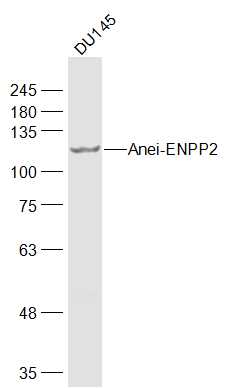 DU145 cell lysates probed with ENPP2 Polyclonal Antibody, Unconjugated (bs-2437R) at 1:1000 dilution and 4˚C overnight incubation. Followed by conjugated secondary antibody incubation at 1:10000 for 60 min at 37˚C.
