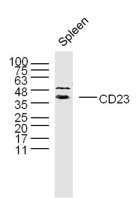 Mouse spleen lysates probed with CD23 Polyclonal Antibody, Unconjugated (bs-2490R) at 1:300 dilution and 4˚C overnight incubation. Followed by conjugated secondary antibody incubation at 1:10000 for 60 min at 37˚C.
