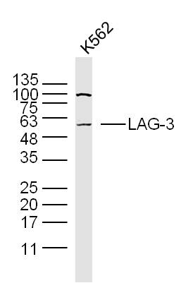 K562 cell lysates probed with LAG-3 Polyclonal Antibody, Unconjugated (bs-2646R) at 1:300 dilution and 4˚C overnight incubation. Followed by conjugated secondary antibody incubation at 1:20000 for 60 min at 37˚C. K562 cell lysates probed with LAG-3 Polyclonal Antibody, Unconjugated (bs-2646R) at 1:300 dilution and 4˚C overnight incubation. Followed by conjugated secondary antibody incubation at 1:20000 for 60 min at 37˚C.