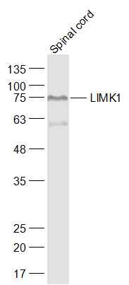 Mouse spinal cord lysates probed with LIMK1 Polyclonal Antibody, Unconjugated (bs-2775R) at 1:1000 dilution and 4˚C overnight incubation. Followed by conjugated secondary antibody incubation at 1:20000 for 60 min at 37˚C.