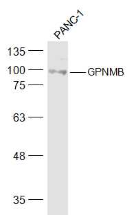 PANC-1 cell lysates probed with GPNMB Polyclonal Antibody, Unconjugated (bs-2684R) at 1:500 dilution and 4˚C overnight incubation. Followed by conjugated secondary antibody incubation at 1:20000 for 60 min at 37˚C.