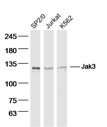 Lane 1: SP2/0 cell lysates; Lane 2: Jurkat cell lysates; Lane 3: K562 cell lysates probed with Jak3 Polyclonal Antibody, Unconjugated (bs-2808R) at 1:300 dilution and 4˚C overnight incubation. Followed by conjugated secondary antibody incubation at 1:20000 for 60 min at 37˚C. Lane 1: SP2/0 cell lysates; Lane 2: Jurkat cell lysates; Lane 3: K562 cell lysates probed with Jak3 Polyclonal Antibody, Unconjugated (bs-2808R) at 1:300 dilution and 4˚C overnight incubation. Followed by conjugated secondary antibody incubation at 1:20000 for 60 min at 37˚C.