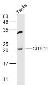 Rat testis lysates probed with CITED1 Polyclonal Antibody, Unconjugated (bs-2990R) at 1:500 dilution and 4˚C overnight incubation. Followed by conjugated secondary antibody incubation at 1:20000 for 60 min at 37˚C.