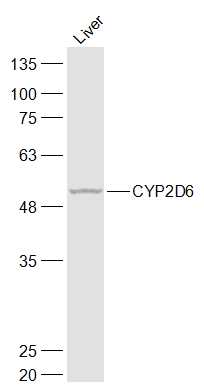 Rat Liver lysates probed with CYP2D6 Polyclonal Antibody, Unconjugated (bs-2991R) at 1:1000 dilution and 4˚C overnight incubation. Followed by conjugated secondary antibody incubation at 1:20000 for 60 min at 37˚C.
