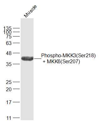 Mouse muscle lysates probed with MKK3(Ser218) + MKK6(Ser207) Polyclonal Antibody, Unconjugated (bs-3274R) at 1:1000 dilution and 4˚C overnight incubation. Followed by conjugated secondary antibody incubation at 1:20000 for 60 min at 37˚C.