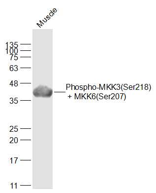 Rat muscle lysates probed with MKK3(Ser218) + MKK6(Ser207) Polyclonal Antibody, Unconjugated (bs-3274R) at 1:1000 dilution and 4˚C overnight incubation. Followed by conjugated secondary antibody incubation at 1:20000 for 60 min at 37˚C.