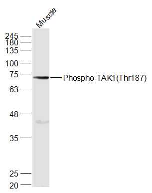 Mouse muscle lysates probed with TAK1(Thr187) Polyclonal Antibody, Unconjugated (bs-3438R) at 1:1000 dilution and 4˚C overnight incubation. Followed by conjugated secondary antibody incubation at 1:20000 for 60 min at 37˚C.