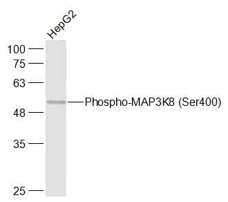 HepG2 cell lysates probed with MAP3K8 (Ser400) Polyclonal Antibody, Unconjugated (bs-3454R) at 1:1000 dilution and 4˚C overnight incubation. Followed by conjugated secondary antibody incubation at 1:20000 for 60 min at 37˚C.