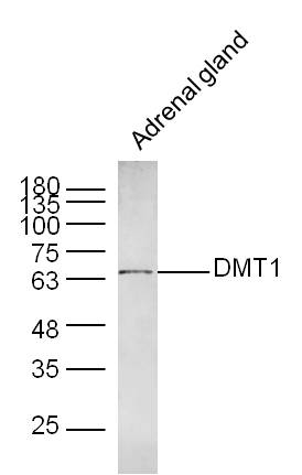 Mouse adrenal gland lysates probed with DMT1 Polyclonal Antibody, Unconjugated (bs-3577R) at 1:300 dilution and 4˚C overnight incubation. Followed by conjugated secondary antibody incubation at 1:20000 for 60 min at 37˚C. Mouse adrenal gland lysates probed with DMT1 Polyclonal Antibody, Unconjugated (bs-3577R) at 1:300 dilution and 4˚C overnight incubation. Followed by conjugated secondary antibody incubation at 1:20000 for 60 min at 37˚C.