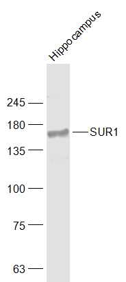 Rat hippocampus lysates probed with SUR1 Polyclonal Antibody, Unconjugated (bs-3641R) at 1:1000 dilution and 4˚C overnight incubation. Followed by conjugated secondary antibody incubation at 1:20000 for 60 min at 37˚C.