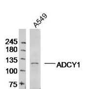 A549 cell lysates probed with ADCY1 Polyclonal Antibody, Unconjugated (bs-3681R) at 1:300 dilution and 4˚C overnight incubation. Followed by conjugated secondary antibody incubation at 1:20000 for 60 min at 37˚C.