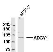 MCF-7 cell lysates probed with ADCY1 Polyclonal Antibody, Unconjugated (bs-3681R) at 1:300 dilution and 4˚C overnight incubation. Followed by conjugated secondary antibody incubation at 1:20000 for 60 min at 37˚C.
