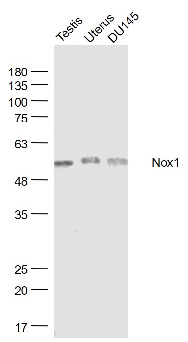 Lane 1: Mouse testis lysates; Lane 2: Mouse uterus lysates; Lane 3: DU145 cell lysates probed with Nox1 Polyclonal Antibody, Unconjugated (bs-3682R) at 1:1000 dilution and 4˚C overnight incubation. Followed by conjugated secondary antibody incubation at 1:20000 for 60 min at 37˚C.