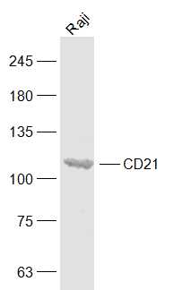 Raji lysates probed with CD21 Polyclonal Antibody, Unconjugated (bs-3792R) at 1:1000 dilution and 4˚C overnight incubation. Followed by conjugated secondary antibody incubation at 1:20000 for 60 min at 37˚C.