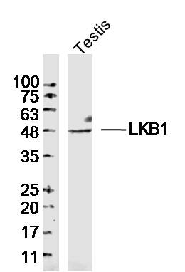 Mouse testis lysates probed with LKB1 Polyclonal Antibody, Unconjugated (bs-3948R) at 1:300 dilution and 4˚C overnight incubation. Followed by conjugated secondary antibody incubation at 1:20000 for 60 min at 37˚C.