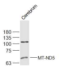 Rat Cerebrum lysates probed with MT-ND5 Polyclonal Antibody, Unconjugated (bs-3952R) at 1:500 dilution and 4˚C overnight incubation. Followed by conjugated secondary antibody incubation at 1:20000 for 60 min at 37˚C.