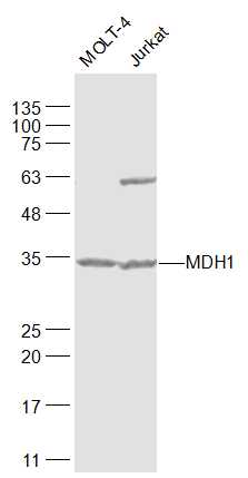 Lane 1: MOLT-4 cell lysates; Lane 2: Jurkat cell lysates probed with MDH1 Polyclonal Antibody, Unconjugated (bs-3996R) at 1:1000 dilution and 4˚C overnight incubation. Followed by conjugated secondary antibody incubation at 1:20000 for 60 min at 37˚C.