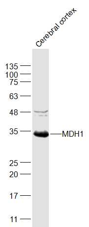 Rat cerebral cortex lysates probed with MDH1 Polyclonal Antibody, Unconjugated (bs-3996R) at 1:1000 dilution and 4˚C overnight incubation. Followed by conjugated secondary antibody incubation at 1:20000 for 60 min at 37˚C.