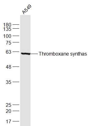 A549 cell lysates probed with Thromboxane synthase Polyclonal Antibody, Unconjugated (bs-4019R) at 1:1000 dilution and 4˚C overnight incubation. Followed by conjugated secondary antibody incubation at 1:20000 for 60 min at 37˚C.