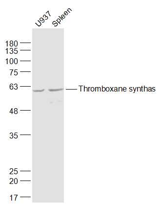 Lane 1: U937 cell lysates; Lane 2: Mouse spleen lysates probed with Thromboxane synthase Polyclonal Antibody, Unconjugated (bs-4019R) at 1:1000 dilution and 4˚C overnight incubation. Followed by conjugated secondary antibody incubation at 1:20000 for 60 min at 37˚C.