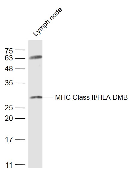 Mouse lymph node lysates probed with MHC Class II/HLA DMB Polyclonal Antibody, Unconjugated (bs-4107R) at 1:500 dilution and 4˚C overnight incubation. Followed by conjugated secondary antibody incubation at 1:20000 for 60 min at 37˚C.