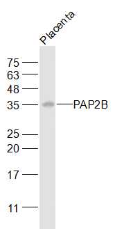 Mouse placenta lysates probed with PAP2B Polyclonal Antibody, Unconjugated (bs-4127R) at 1:1000 dilution and 4˚C overnight incubation. Followed by conjugated secondary antibody incubation at 1:20000 for 60 min at 37˚C.