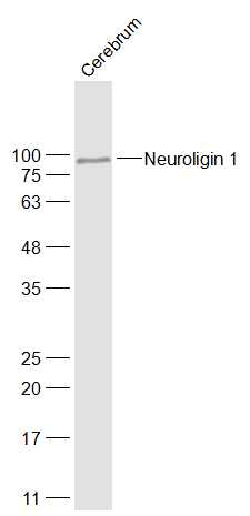 Rat Cerebrum lysates probed with Neuroligin 1 Polyclonal Antibody, Unconjugated (bs-4212R) at 1:1000 dilution and 4˚C overnight incubation. Followed by conjugated secondary antibody incubation at 1:20000 for 60 min at 37˚C.